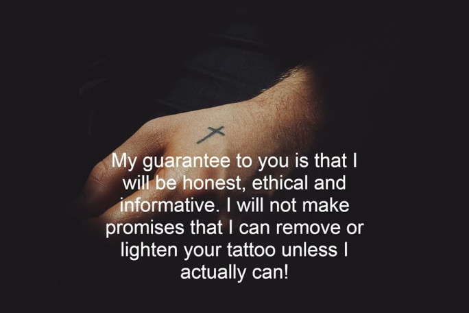 Laser Tattoo Removal Business for Sale Auckland